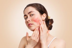 vaisseau sanguin éclaté sur le visage